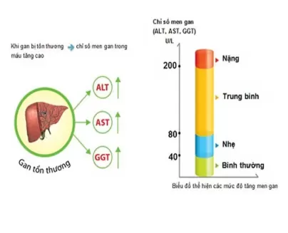 Gói xét nghiệm chức năng gan (toàn diện 10 chỉ số)